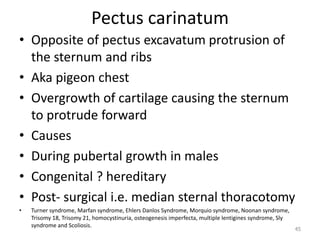 Pectus carinatum 
• Opposite of pectus excavatum protrusion of 
the sternum and ribs 
• Aka pigeon chest 
• Overgrowth of cartilage causing the sternum 
to protrude forward 
• Causes 
• During pubertal growth in males 
• Congenital ? hereditary 
• Post- surgical i.e. median sternal thoracotomy 
• Turner syndrome, Marfan syndrome, Ehlers Danlos Syndrome, Morquio syndrome, Noonan syndrome, 
Trisomy 18, Trisomy 21, homocystinuria, osteogenesis imperfecta, multiple lentigines syndrome, Sly 
syndrome and Scoliosis. 
45 
 