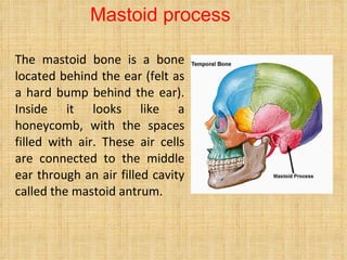 The mastoid bone is a bone located behind the ear (felt as a hard bump behind the ear). Inside it looks like a honeycomb, with the spaces filled with air. These air cells are connected to the middle ear through an air filled cavity called the mastoid antrum.  Mastoid process 