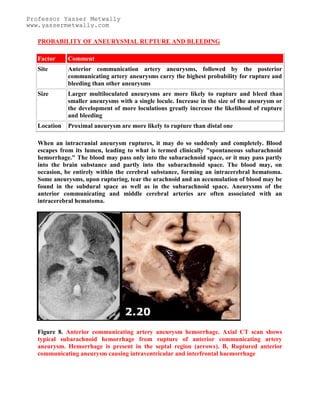 Topic of the month: Radiological pathology of intracranial aneurysms | PDF