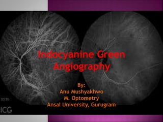 Indocyanine Green
Angiography
By:
Anu Mushyakhwo
M. Optometry
Ansal University, Gurugram
 