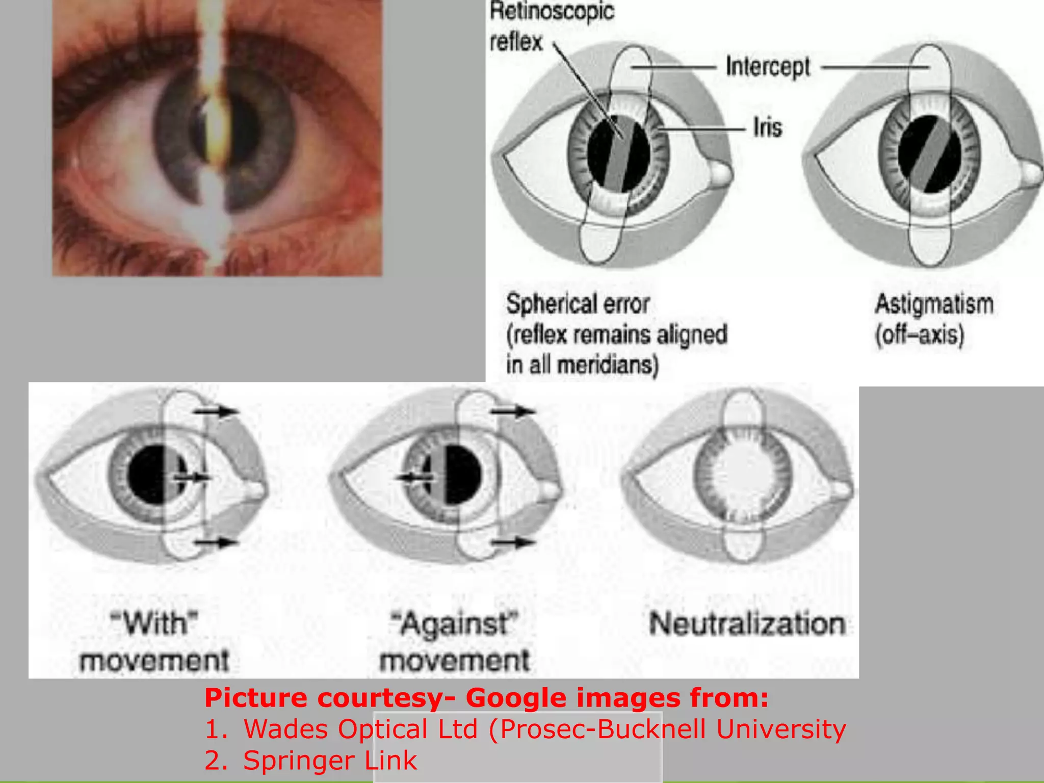 Picture courtesy- Google images from:
1. Wades Optical Ltd (Prosec-Bucknell University
2. Springer Link
 
