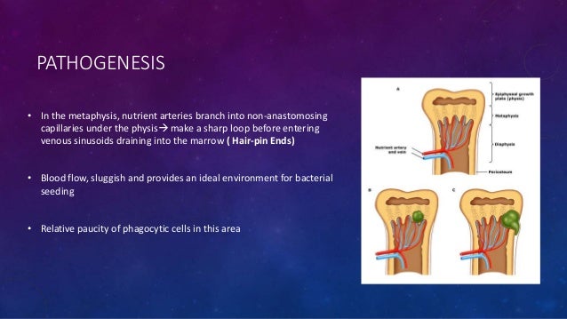 Hematogenous Osteomyelitis hip bone diagram 