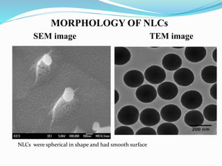 MORPHOLOGY OF NLCs
NLCs were spherical in shape and had smooth surface
SEM image TEM image
 