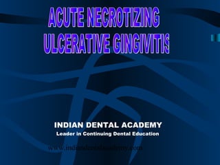  
 INDIAN DENTAL ACADEMY
  Leader in Continuing Dental Education

www.indiandentalacademy.com
 