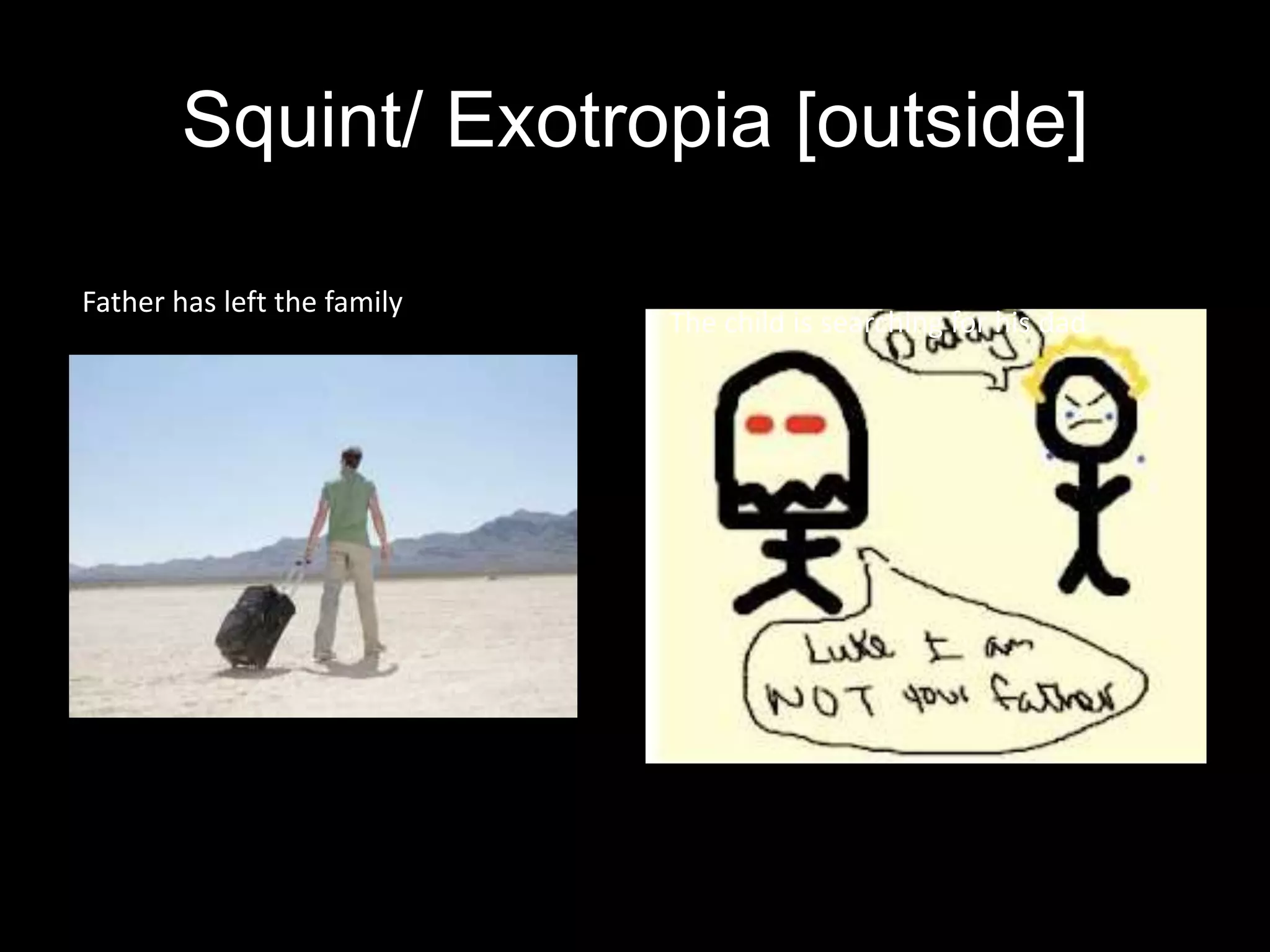 Squint/ Exotropia [outside]
Father has left the family
The child is searching for his dad
 