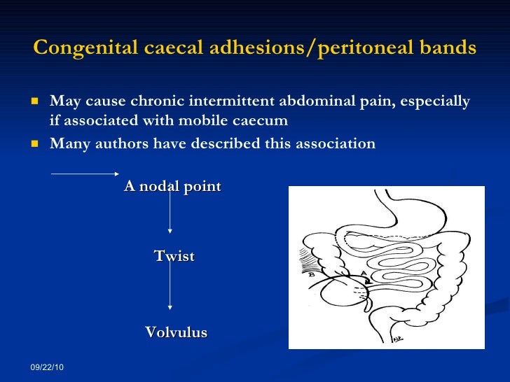 An unusual cause of colic