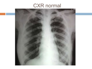 CXR normal
 