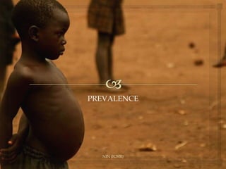 NIN (ICMR)
PREVALENCE
 