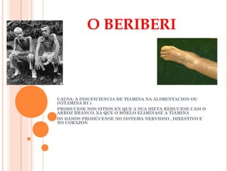 O BERIBERI

CAUSA: A INSUFICIENCIA DE TIAMINA NA ALIMENTACION OU
(VITAMINA B1 )
PRODUCESE NOS SITIOS EN QUE A SUA DIETA REDUCESE CASI O
ARROZ BRANCO, XA QUE O MOELO ELIMINASE A TIAMINA
OS DANOS PRODÚCENSE NO SISTEMA NERVIOSO , DIXESTIVO E
NO CORAZON

 