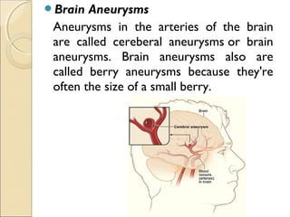 Brain Aneurysms
Aneurysms in the arteries of the brain
are called cereberal aneurysms or brain
aneurysms. Brain aneurysms also are
called berry aneurysms because they're
often the size of a small berry.
 