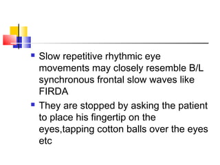  Slow repetitive rhythmic eye
movements may closely resemble B/L
synchronous frontal slow waves like
FIRDA
 They are stopped by asking the patient
to place his fingertip on the
eyes,tapping cotton balls over the eyes
etc
 