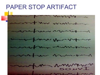 PAPER STOP ARTIFACT
 