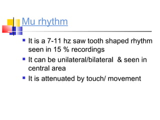 Mu rhythm
 It is a 7-11 hz saw tooth shaped rhythm
seen in 15 % recordings
 It can be unilateral/bilateral & seen in
central area
 It is attenuated by touch/ movement
 