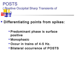 POSTS
( Positive Occipital Sharp Transients of
sleep)
 Differentiating points from spikes:

Predominant phase is surface
positive

Monophasic

Occur in trains of 4-5 Hz.

Bilateral occurrence of POSTS
 