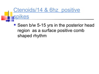 Ctenoids/14 & 6hz positive
spikes
 Seen b/w 5-15 yrs in the posterior head
region as a surface positive comb
shaped rhythm
 