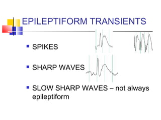 EPILEPTIFORM TRANSIENTS
 SPIKES
 SHARP WAVES
 SLOW SHARP WAVES – not always
epileptiform
 