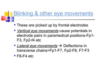 Blinking & other eye movements
 These are picked up by frontal electrodes
 Vertical eye movements cause potentials in
electrode pairs in paramedical positions-Fp1-
F3, Fp2-f4 etc
 Lateral eye movements  Deflections in
transverse chains=Fp1-F7, Fp2-F8, F7-F3
 F8-F4 etc
 
