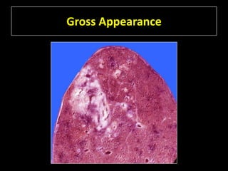 Gross Appearance
 