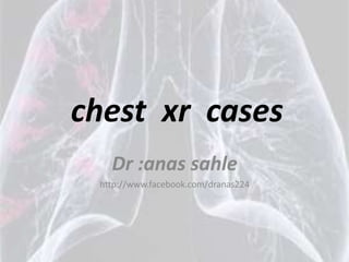 chest xr cases
   Dr :anas sahle
 http://www.facebook.com/dranas224
 