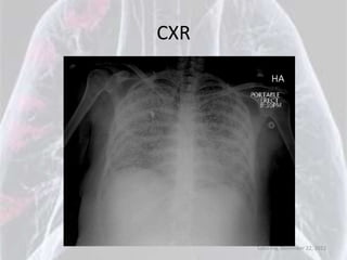 CXR




      Saturday, December 22, 2012
 