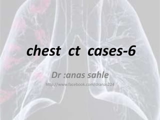 chest ct cases-6
    Dr :anas sahle
  http://www.facebook.com/dranas224
 