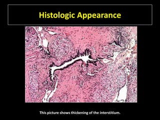 Histologic Appearance




This picture shows thickening of the interstitium.
 