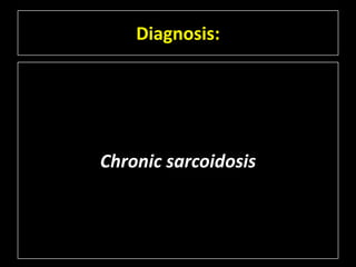 Diagnosis:




Chronic sarcoidosis
 