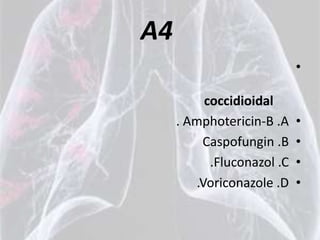 A4
                             •

           coccidioidal
     . Amphotericin-B .A     •
          Caspofungin .B     •
            .Fluconazol .C   •
         .Voriconazole .D    •
 