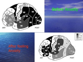 Before Anxiety After feeling Anxiety 