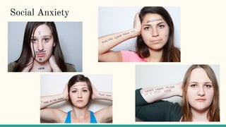 Social Anxiety
 