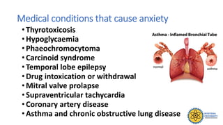 Medical conditions that cause anxiety
•Thyrotoxicosis
•Hypoglycaemia
•Phaeochromocytoma
•Carcinoid syndrome
•Temporal lobe epilepsy
•Drug intoxication or withdrawal
•Mitral valve prolapse
•Supraventricular tachycardia
•Coronary artery disease
•Asthma and chronic obstructive lung disease
 