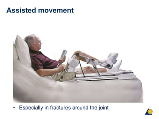 AO-Principles of fracture fixation .pptx