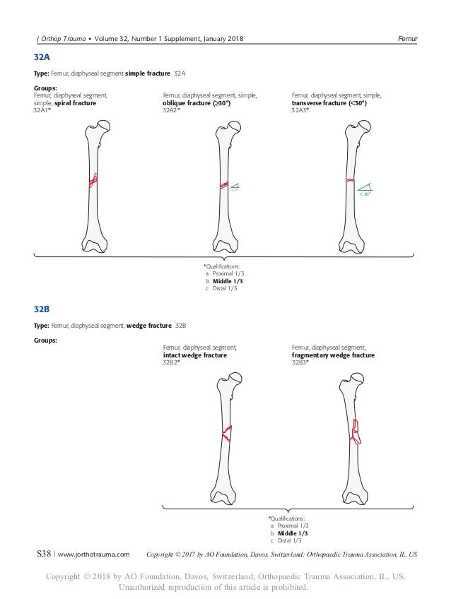 Ao 18