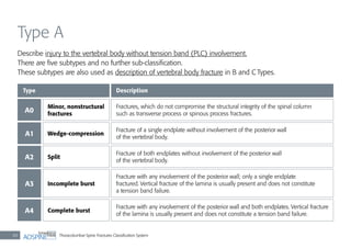 Thoracolumbar Spine Fractures Classiﬁcation System40
Type A
Describe injury to the vertebral body without tension band (PLC) involvement.
There are ﬁve subtypes and no further sub-classiﬁcation.
These subtypes are also used as description of vertebral body fracture in B and C Types.
Type
A0
A2
A1
A3
A4
Description
Fractures, which do not compromise the structural integrity of the spinal column
such as transverse process or spinous process fractures.
Fracture of both endplates without involvement of the posterior wall
of the vertebral body.
Fracture of a single endplate without involvement of the posterior wall
of the vertebral body.
Fracture with any involvement of the posterior wall; only a single endplate
fractured. Vertical fracture of the lamina is usually present and does not constitute
a tension band failure.
Fracture with any involvement of the posterior wall and both endplates. Vertical fracture
of the lamina is usually present and does not constitute a tension band failure.
Minor, nonstructural
fractures
Split
Wedge-compression
Incomplete burst
Complete burst
 