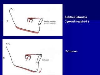 Anterior Open Bite and Deep Bite | PPTX