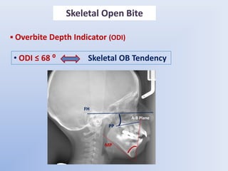 Anterior Open Bite    etiology and differential diagnosis