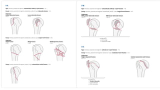 Comprehensive AO Classification of Axial and Appendicular Skeleton ...