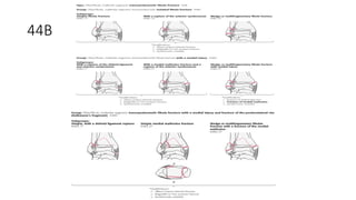 Comprehensive AO Classification of Axial and Appendicular Skeleton ...
