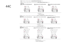 Comprehensive AO Classification of Axial and Appendicular Skeleton ...