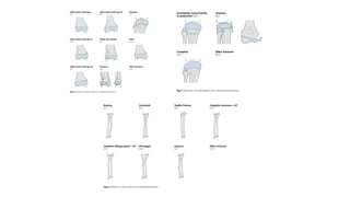 Comprehensive AO Classification of Axial and Appendicular Skeleton ...