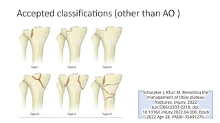 Comprehensive AO Classification of Axial and Appendicular Skeleton ...