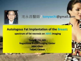 Autologous Fat Implantation of the Breast:
spectrum of fat necrosis on ABVS imaging
Tony W Chi, MD
Nagashima Breast Imaging Center
NBIC Clinic
Taipei, Taiwan
 