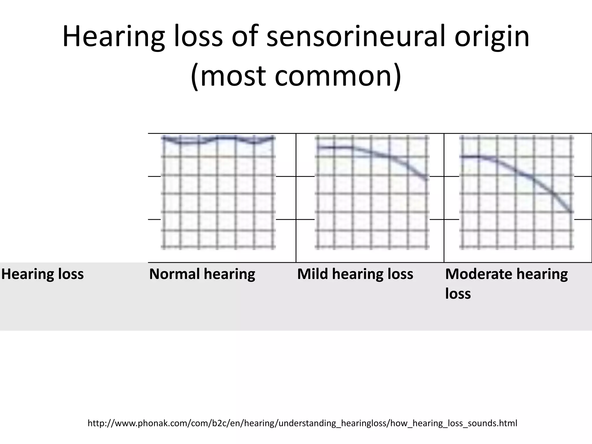 Hearing loss of sensorineural origin
(most common)

Hearing loss

Normal hearing

Mild hearing loss

Moderate hearing
loss

http://www.phonak.com/com/b2c/en/hearing/understanding_hearingloss/how_hearing_loss_sounds.html

 