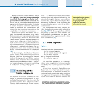 ao surgery reference about how to manage fractures of bones | PDF