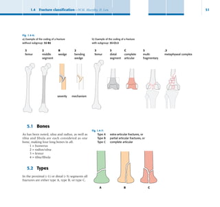 ao surgery reference about how to manage fractures of bones | PDF