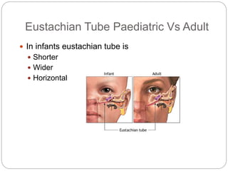 Eustachian Tube Paediatric Vs Adult
 In infants eustachian tube is
 Shorter
 Wider
 Horizontal
 