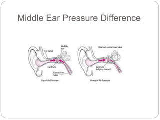 Middle Ear Pressure Difference
 
