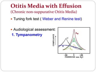 Otitis Media with Effusion
(Chronic non-suppurative Otitis Media)
 Tuning fork test ( Weber and Renine test)
 Audiological assessment:
1. Tympanometry
 