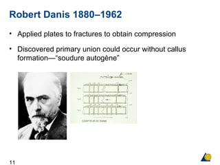11
Robert Danis 1880–1962
• Applied plates to fractures to obtain compression
• Discovered primary union could occur without callus
formation—“soudure autogène”
 
