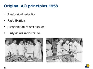 17
Original AO principles 1958
• Anatomical reduction
• Rigid fixation
• Preservation of soft tissues
• Early active mobilization
 